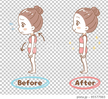 Female posture correction before and after set 95577983