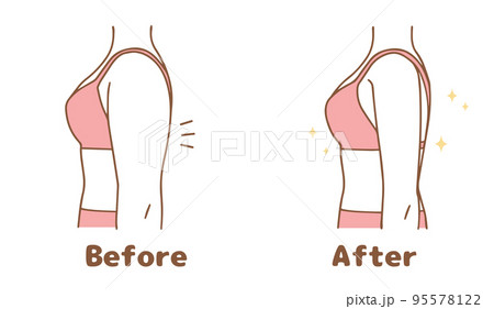 二の腕　ビフォーアフターのセット 95578122