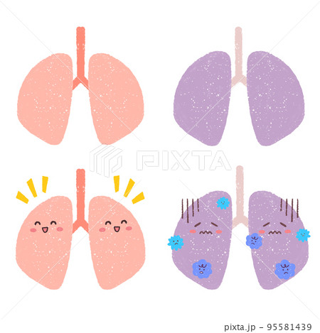 健康な肺と不健康な肺のセットイラスト 95581439