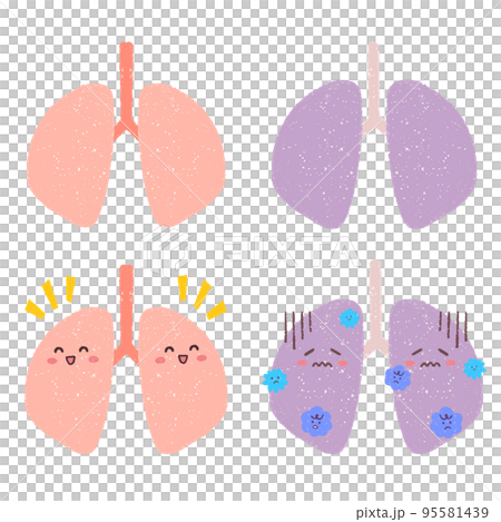 健康な肺と不健康な肺のセットイラスト 95581439