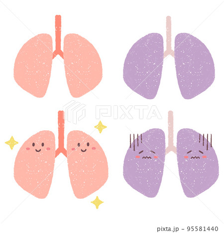 健康な肺と不健康な肺のセットイラスト 健康な肺と不健康な肺のセットイラスト 95581440
