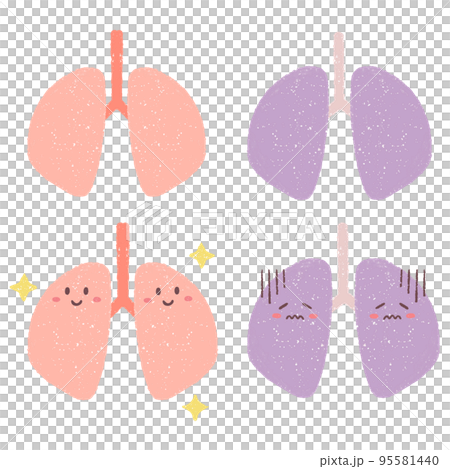 健康な肺と不健康な肺のセットイラスト 健康な肺と不健康な肺のセットイラスト 95581440