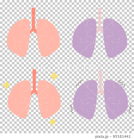 健康な肺と不健康な肺のセットイラスト 95581441
