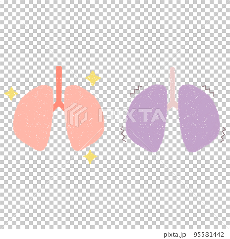 健康な肺と不健康な肺のセットイラスト 95581442