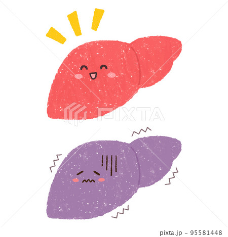 健康な肝臓と不調な肝臓のセットイラスト 95581448