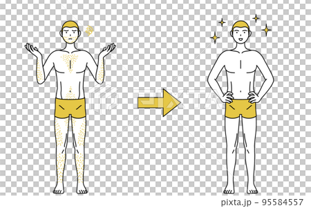 Image of medical hair removal, before and after a man who is worried about having thick body hair loses his hair and becomes full of confidence 95584557
