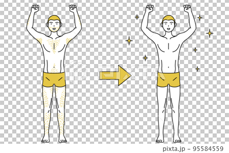 Image of medical hair removal, before and after a man who is worried about having thick body hair loses hair and becomes smooth 95584559