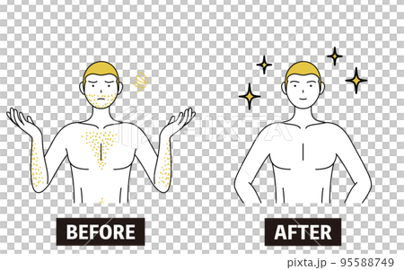 医療脱毛のイメージ、体毛が濃くて悩んでいる男性が脱毛して自信満々になるビフォーアフター 95588749