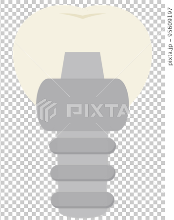 Implant Implant 95609197