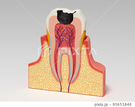 歯 歯の構造 人体 図解 リアル CG 歯 歯の構造 人体 図解 リアル CG 95653848