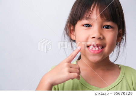Portrait of an Asian girl with broken upper baby teeth and first permanent teeth. Friendly little girl showing her broken teeth isolated on white background. Portrait of an Asian girl with broken upper baby teeth and first permanent teeth. Friendly little girl showing her broken teeth isolated on white background. 95670229