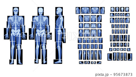 Set of X-Ray Skeleton Human body - hands, legs, chests, heads, vertebra, pelvis, Bones adult people roentgen front back 95673873