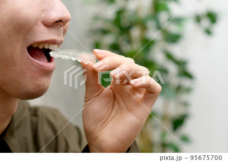 若い男性がマウスピースを装着するイメージ 若い男性がマウスピースを装着するイメージ 95675700