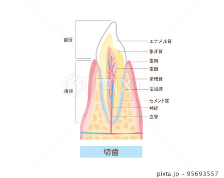 歯の構造と名称/断面図のベクターイラスト素材 95693557