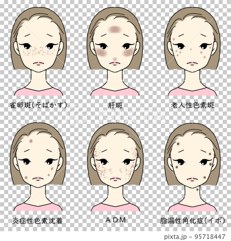 適合患有瑕疵和雀斑的女性的套裝 帶有字母的瑕疵類型 95718447