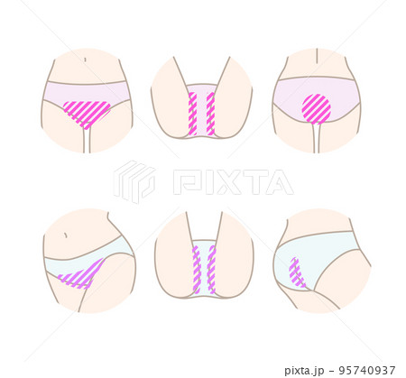 脱毛サロンや脱毛器の部位説明のVIOイラスト素材セット 95740937