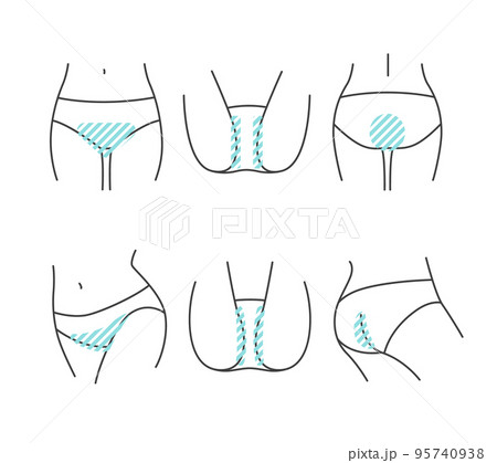 脱毛部位の説明のためのVIOイラスト素材セット 95740938