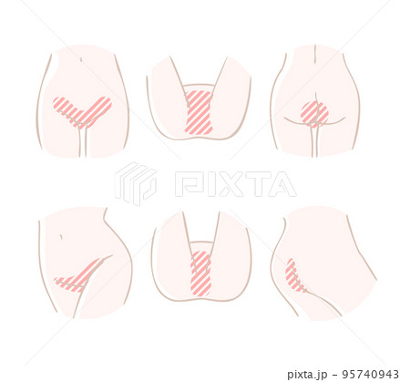 下腹部から股にかけての脱毛部位のアイコン素材セット(下着なし・裸) 下腹部から股にかけての脱毛部位のアイコン素材セット(下着なし・裸) 95740943