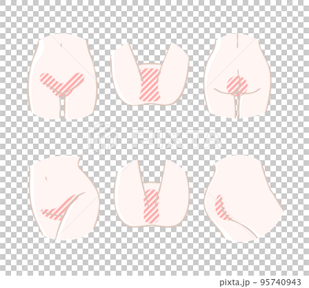 下腹部から股にかけての脱毛部位のアイコン素材セット(下着なし・裸) 下腹部から股にかけての脱毛部位のアイコン素材セット(下着なし・裸) 95740943