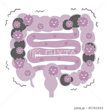 小腸まで悪玉菌だらけ　大腸と小腸のイラスト 95761832