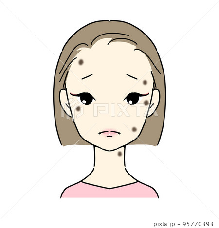 シミ・そばかすに悩む女性　(脂漏性角化症・イボ) 95770393
