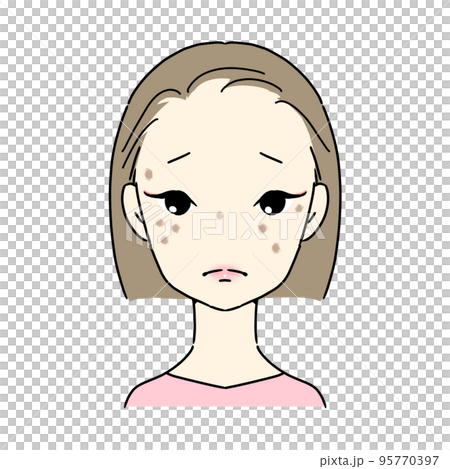 シミ・そばかすに悩む女性 (老人性色素斑) シミ・そばかすに悩む女性 (老人性色素斑) 95770397