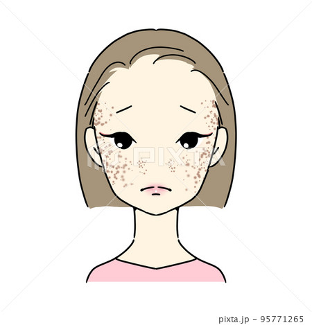 シミ・そばかすに悩む女性　(ADM) 95771265