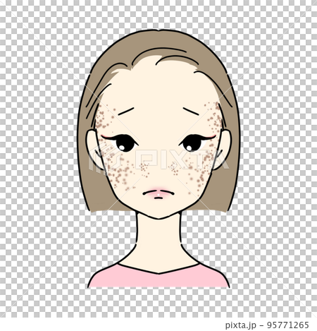 シミ・そばかすに悩む女性　(ADM) 95771265
