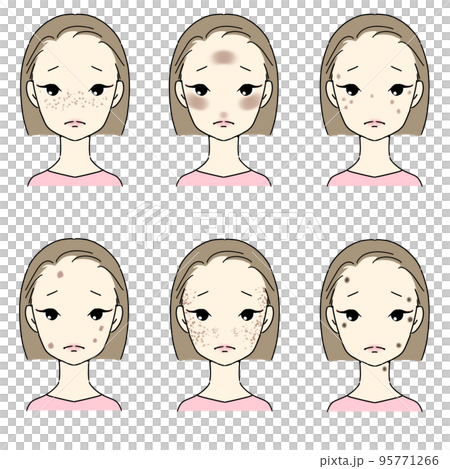 A set for women who suffer from blemishes and freckles Types of blemishes No letters A set for women who suffer from blemishes and freckles Types of blemishes No letters 95771266