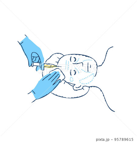 整形手術　美容整形外科で顔に注射をしているシーン 95789615