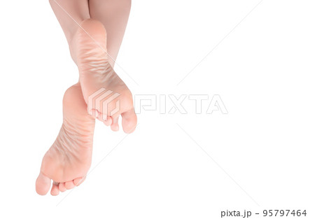 female legs, feet, foot in an elegant position. woman legs with rough and dry skin on heels of her feet after using moisturizer. isolated on white background. copy space 95797464