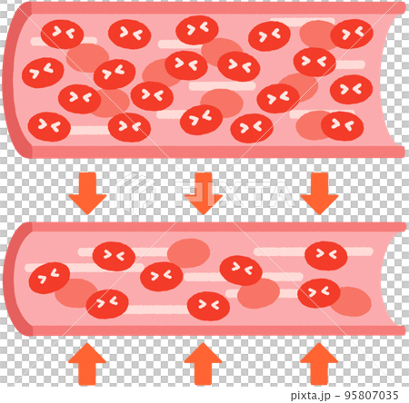 Blood vessel (hypertension) _ with expression 95807035