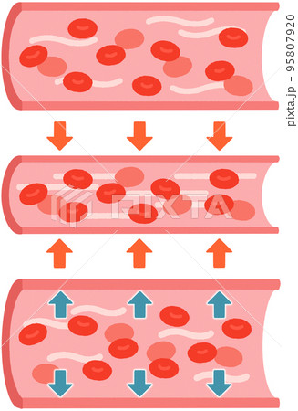 血管(正常/収縮/拡張) 血管(正常/収縮/拡張) 95807920