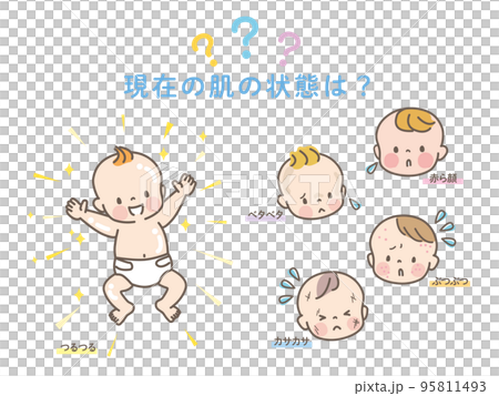 肌荒れした赤ちゃんのビフォーアフター_ベクターイラスト素材 95811493