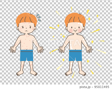 肌荒れに悩む男の子のビフォーアフター_ベクターイラスト素材 95811495