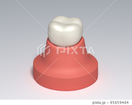 歯 歯の構造 人体 図解 リアル CG 歯 歯の構造 人体 図解 リアル CG 95859484