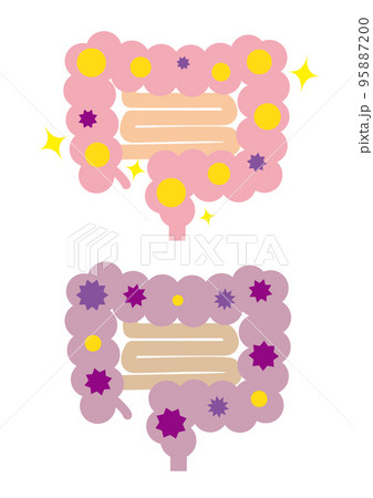 健康な大腸と不健康な大腸　線なし 95887200