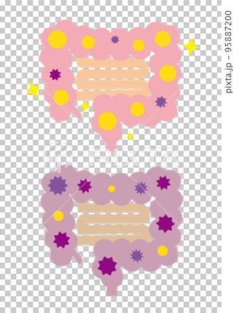 健康な大腸と不健康な大腸　線なし 95887200