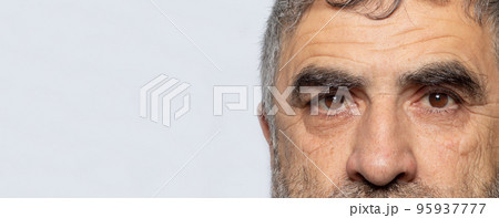 A man with cataracts is a disease of the lens of the human eye, clouding. Comparison of healthy and sick eye banner with place for text on a gray background. A man with cataracts is a disease of the lens of the human eye, clouding. Comparison of healthy and sick eye banner with place for text on a gray background. 95937777