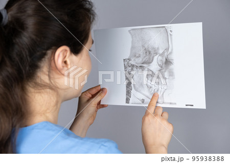 The doctor holds a CT scan of a patient with temporomandibular joint dysfunction and malocclusion. The doctor holds a CT scan of a patient with temporomandibular joint dysfunction and malocclusion. 95938388