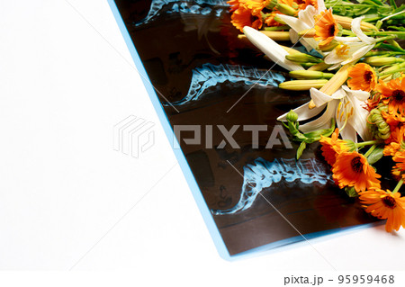 Computed tomography shot of the spine with flowers for congratulations on the day of radiologist, neurologist or traumatologist with place for text copy space on white background 95959468