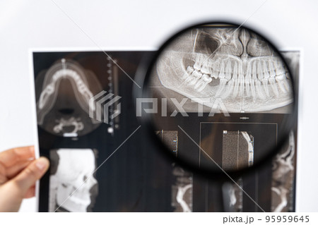 The doctor holds a CT scan of a patient with temporomandibular joint dysfunction and malocclusion. 95959645