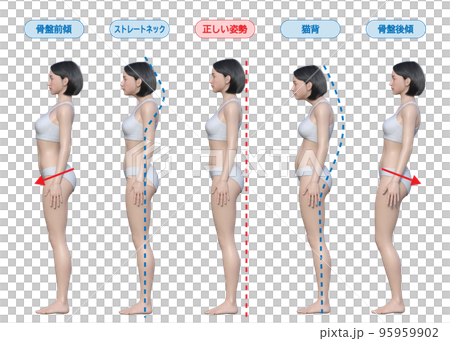 Correct posture, hunchback, straight neck, posterior pelvic tilt, anterior pelvic tilt, Natura 3D model, female full body sideways illustration 95959902