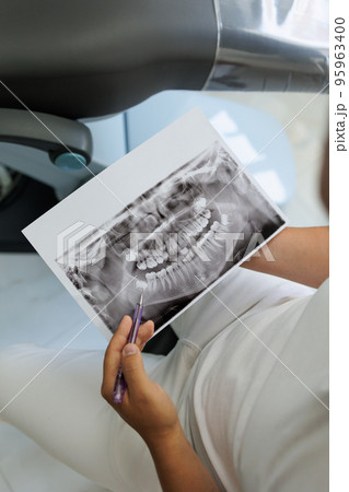 Teeth panoramic x ray professional examination Teeth panoramic x ray professional examination 95963400