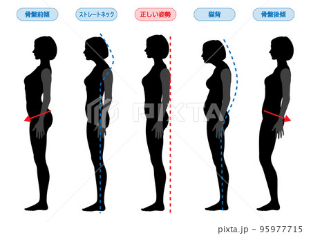 良い姿勢 猫背 反り腰 ストレートネック 骨盤後傾 前傾 女性の全身横向きシルエットのイラスト 良い姿勢 猫背 反り腰 ストレートネック 骨盤後傾 前傾 女性の全身横向きシルエットのイラスト 95977715