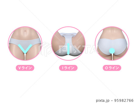女性が気になるアンダーヘアの脱毛 VIO  Vライン Iライン Oラインのイラスト 95982766