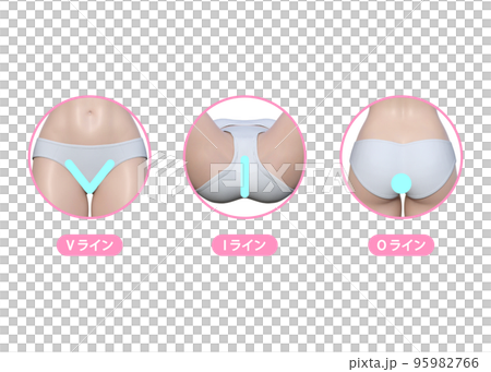 女性が気になるアンダーヘアの脱毛 VIO  Vライン Iライン Oラインのイラスト 95982766