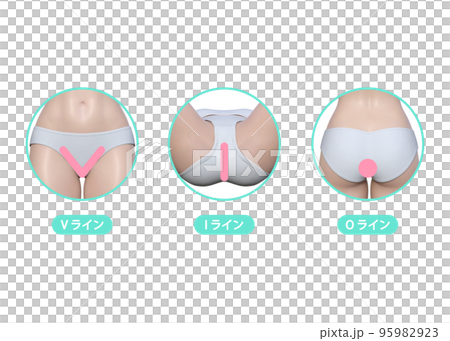 Illustration of hair removal in the delicate areas that women are concerned about: V-line, I-line, O-line Illustration of hair removal in the delicate areas that women are concerned about: V-line, I-line, O-line 95982923