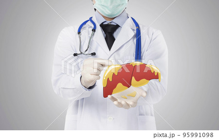 doctor showing fatty liver , liver disease 95991098