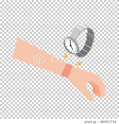 Rough skin due to metal allergy 96061734